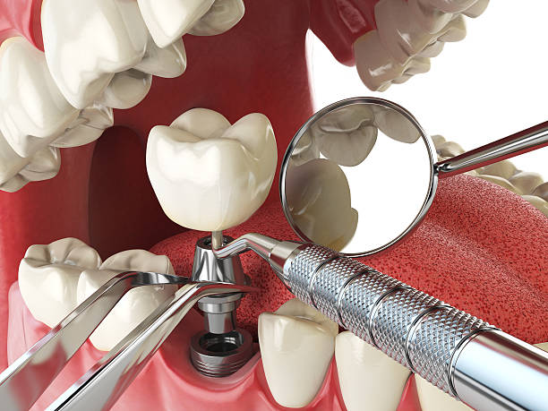 Best Emergency Dentist for Special Needs Patients in Brooksi, DE